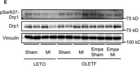 Fig.5.E showing Western Blotting from the publication: Empagliflozin normalizes the size and number of mitochondria and prevents reduction in mitochondrial size after myocardial infarction in diabetic hearts.