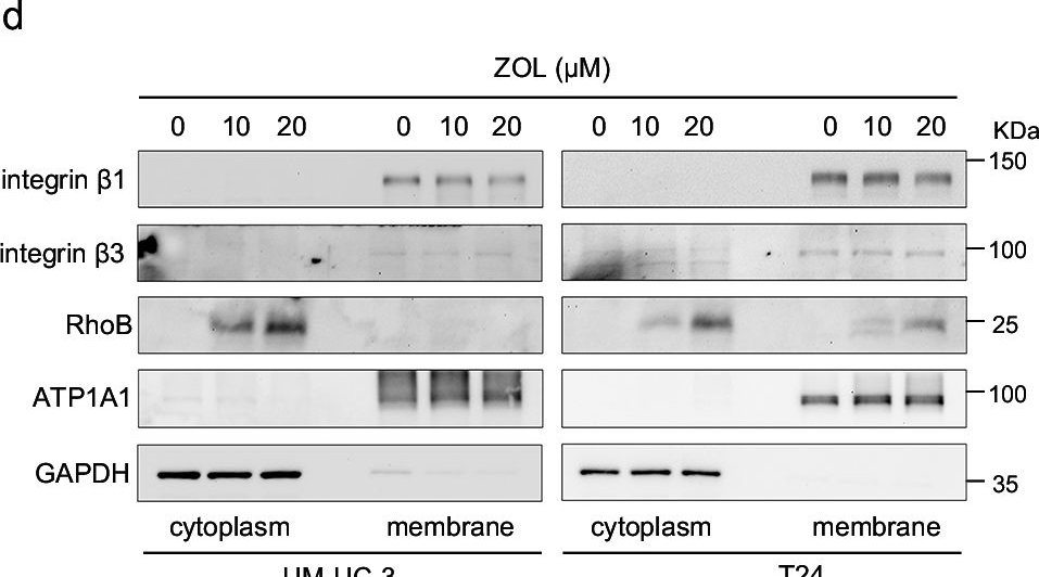 Fig.7.D showing Western Blotting from the publication: Mevalonate pathway inhibition reduces bladder cancer metastasis by modulating RhoB protein stability and integrin β1 localization.