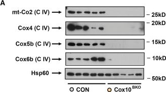 Fig.6.A showing Western Blotting in a Mus musculus (House mouse) sample from the publication: Cox10-mediated mitochondrial respiration in brown adipocytes regulates adaptive thermogenesis and systemic metabolism.