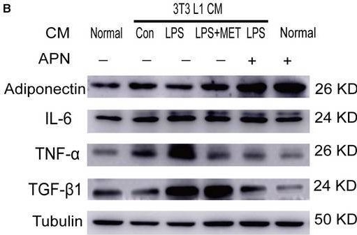 Fig.6.B showing Western Blotting from the publication: Metformin regulates adiponectin signalling in epicardial adipose tissue and reduces atrial fibrillation vulnerability.