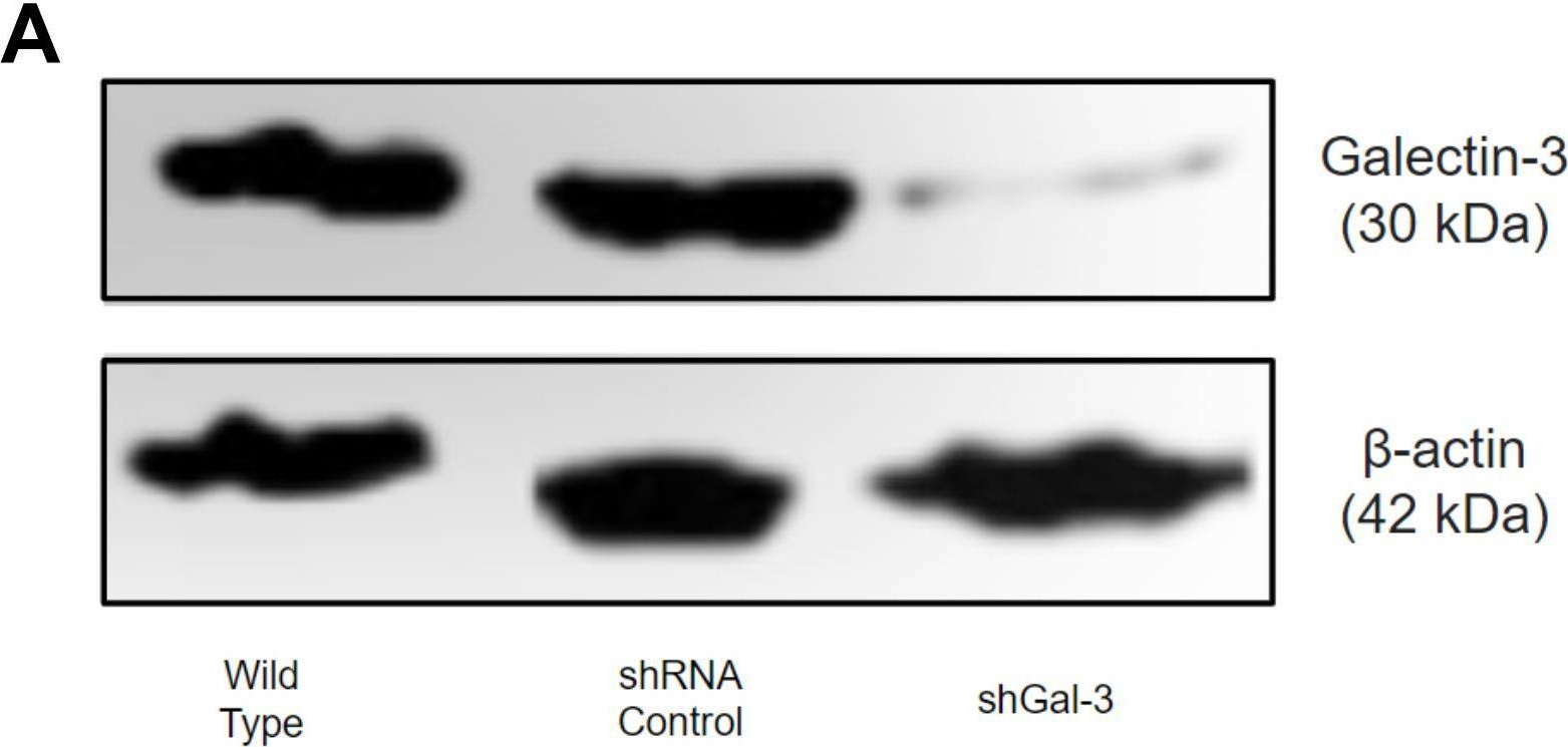 Fig.1.A showing Western Blotting in a Homo sapiens (Human) sample from the publication: Galectin-3 plays a key role in controlling infection by Toxoplasma gondii in human trophoblast cells and human villous explants.