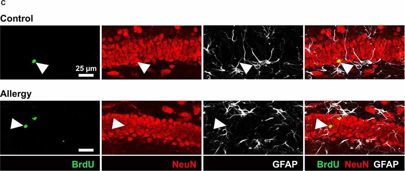 Allergy Enhances Neurogenesis and Modulates Microglial Activation in the Hippocampus.
