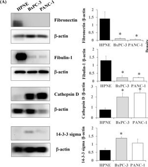 Fig.3.A showing Western Blotting from the publication: Shotgun Label-Free Proteomic Analysis for Identification of a Potential Diagnostic Biomarker for Pancreatic Cancer.