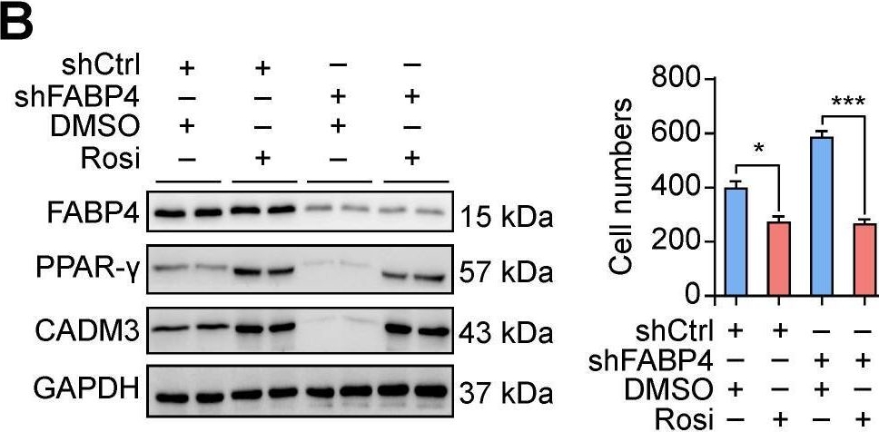 Fig.5.B showing Western Blotting from the publication: The peroxisome proliferator-activated receptor agonist rosiglitazone specifically represses tumour metastatic potential in chromatin inaccessibility-mediated FABP4-deficient gastric cancer.