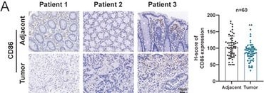 Fig.1.A showing Immunohistochemistry from the publication: The Uridylyl Transferase TUT7-Mediated Accumulation of Exosomal miR-1246 Reprograms TAMs to Support CRC Progression.