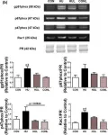 Fig.3.B showing Western Blotting from the publication: Nox2 signaling and muscle fiber remodeling are attenuated by losartan administration during skeletal muscle unloading.