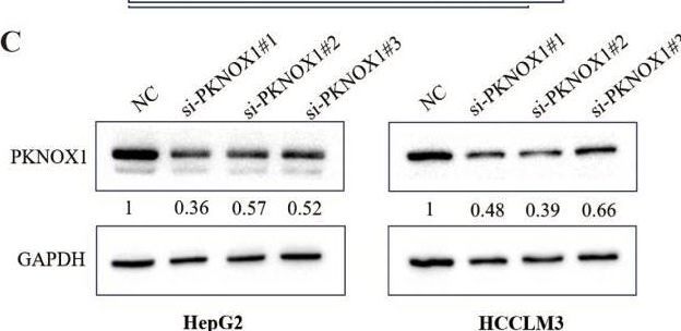 Fig.10.C showing Western Blotting in a Homo sapiens (Human) sample from the publication: Systematic pan-cancer analysis identifies PKNOX1 as a potential prognostic and immunological biomarker and its functional validation.