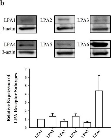 Fig.1.B showing Western Blotting in a Homo sapiens (Human) sample from the publication: Effect of the Gintonin-Enriched Fraction on Glucagon-Like-Protein-1 Release.