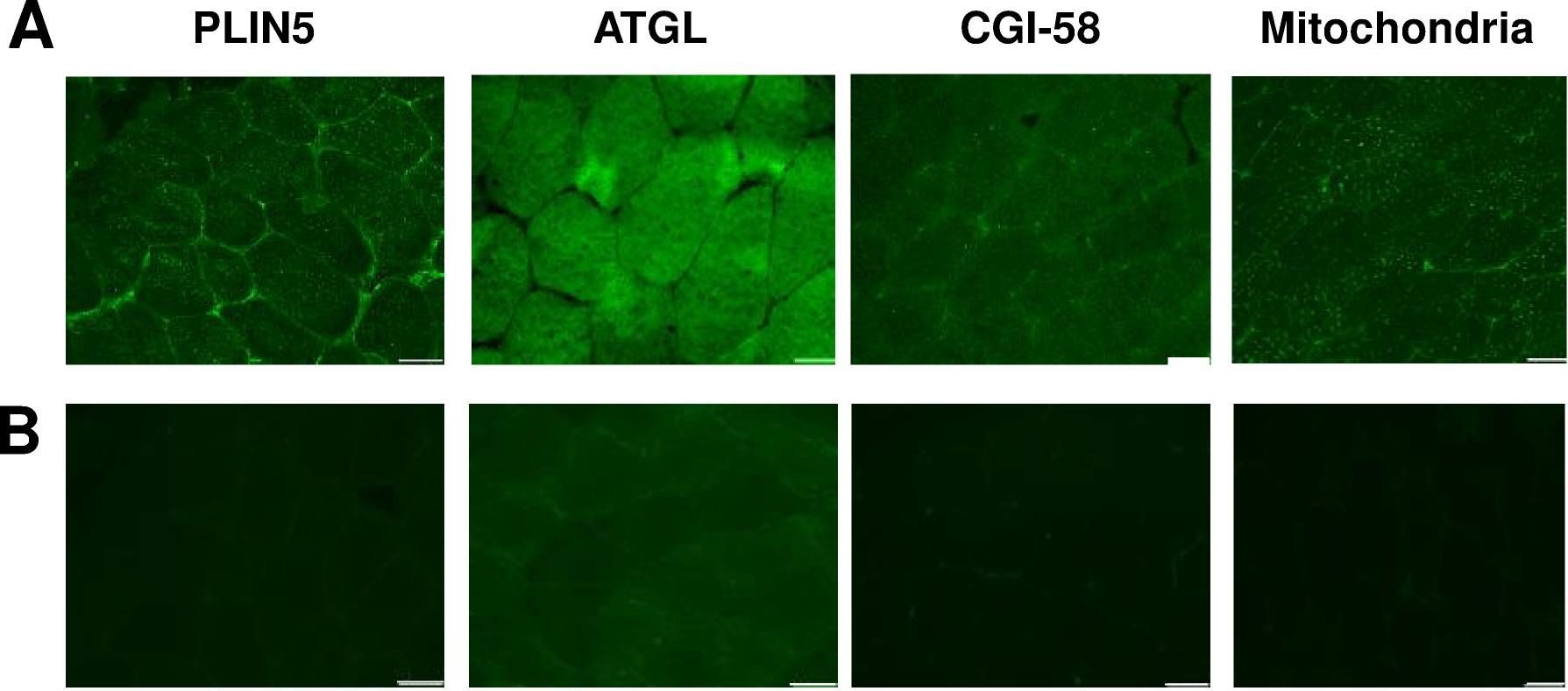 Cellular localization and associations of the major lipolytic proteins in human skeletal muscle at rest and during exercise.