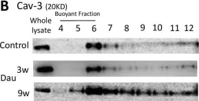Fig.4.B showing Western Blotting from the publication: Modulation of caveolins, integrins and plasma membrane repair proteins in anthracycline-induced heart failure in rabbits.