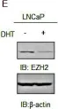 Fig.6.E showing Western Blotting from the publication: RUNX1, an androgen- and EZH2-regulated gene, has differential roles in AR-dependent and -independent prostate cancer.