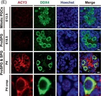 Fig.3.E showing Immunocytochemistry-immunofluorescence in a Mus musculus (House mouse) sample from the publication: Dynamic transcriptomic and regulatory networks underpinning the transition from fetal primordial germ cells to spermatogonia in mice.