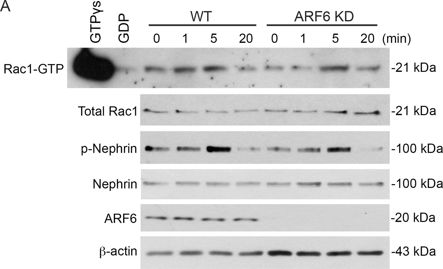 ARF6 mediates nephrin tyrosine phosphorylation-induced podocyte cellular dynamics.