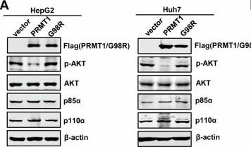 Fig.5.A showing Western Blotting in a Homo sapiens (Human) sample from the publication: Metal-polyphenol-network coated R612F nanoparticles reduce drug resistance in hepatocellular carcinoma by inhibiting stress granules.