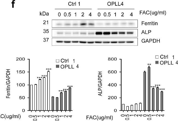Fig.5.F showing Western Blotting from the publication: Regulatory Mechanism between Ferritin and Mitochondrial Reactive Oxygen Species in Spinal Ligament-Derived Cells from Ossification of Posterior Longitudinal Ligament Patient.
