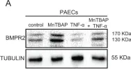 Fig.3.A showing Western Blotting from the publication: MnTBAP Reverses Pulmonary Vascular Remodeling and Improves Cardiac Function in Experimentally Induced Pulmonary Arterial Hypertension.