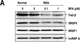 Fig.6.A showing Western Blotting in a Fungi sample from the publication: Regulation of Survival Motor Neuron Gene Expression by Calcium Signaling.