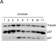 Fig.1.A showing Western Blotting from the publication: p27Kip1 regulates alpha-synuclein expression.