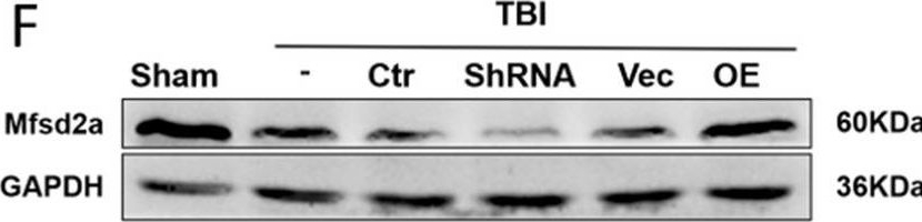 Fig.7.F showing Western Blotting in a Mus musculus (House mouse) sample from the publication: Selective sphingosine-1-phosphate receptor 1 modulator attenuates blood-brain barrier disruption following traumatic brain injury by inhibiting vesicular transcytosis.