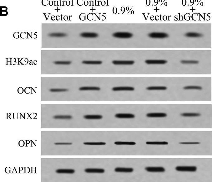 Fig.5.B showing Western Blotting from the publication: Cyclic Mechanical Strain Regulates Osteoblastic Differentiation of Mesenchymal Stem Cells on TiO2 Nanotubes Through GCN5 and Wnt/β-Catenin.