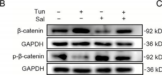 Fig.6.B showing Western Blotting from the publication: The Effect of Cholesterol Efflux on Endothelial Dysfunction Caused by Oxidative Stress.