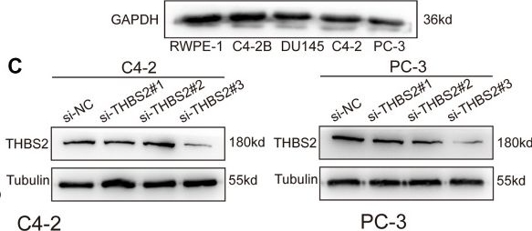 Fig.10.C showing Western Blotting from the publication: Identification of a basement membrane gene signature for predicting prognosis and estimating the tumor immune microenvironment in prostate cancer.