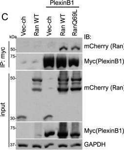 Fig.6.C showing Western Blotting in a Homo sapiens (Human) sample from the publication: B-type Plexins promote the GTPase activity of Ran to affect androgen receptor nuclear translocation in prostate cancer.