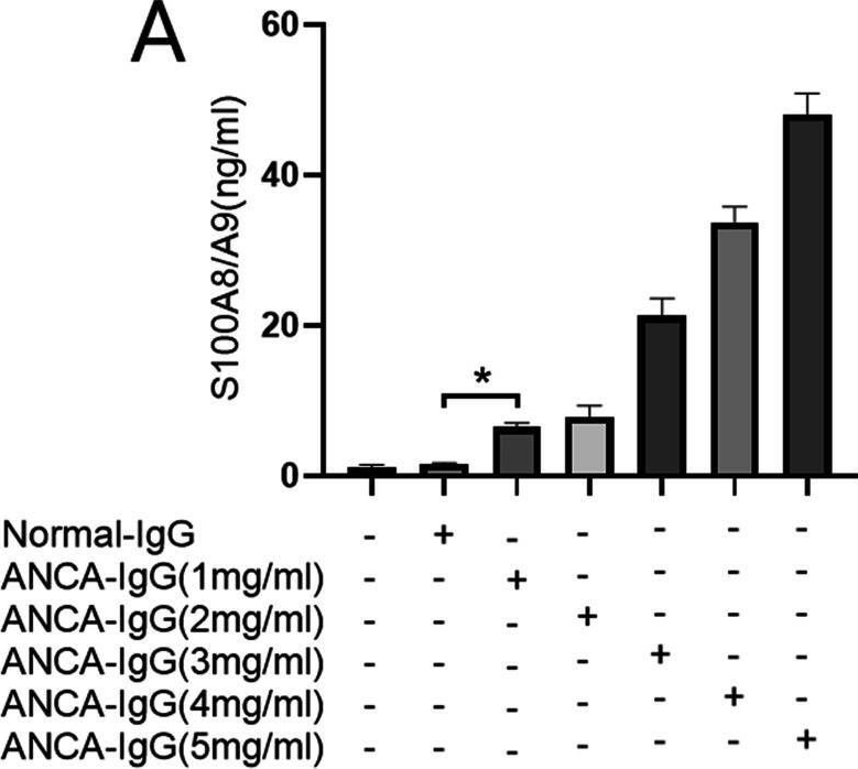 Fig.3.A showing Enzyme-linked immunosorbent assay from the publication: The potential pathogenic roles of S100A8/A9 and S100A12 in patients with MPO-ANCA-positive vasculitis.