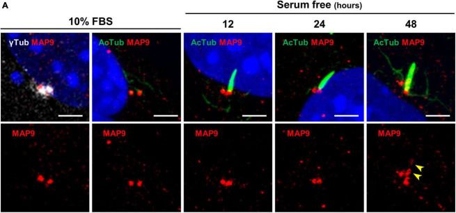 Fig.5.A showing Immunocytochemistry-immunofluorescence in a Mus musculus (House mouse) sample from the publication: Molecular characterization of MAP9 in the photoreceptor sensory cilia as a modifier in canine RPGRIP1-associated cone-rod dystrophy.