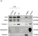 Fig.1.C showing Western Blotting from the publication: NHERF2 as a Novel Biomarker for Distinguishing MAC Pulmonary Disease from Tuberculosis Based on Proteome Analysis of Serum Extracellular Vesicles.