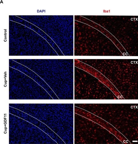 Fig.5.A showing Immunohistochemistry-immunofluorescence from the publication: Growth Differentiation Factor 11 Is a Circulating Regulator of Oligodendrocyte Differentiation and CNS Myelin Formation and Repair.