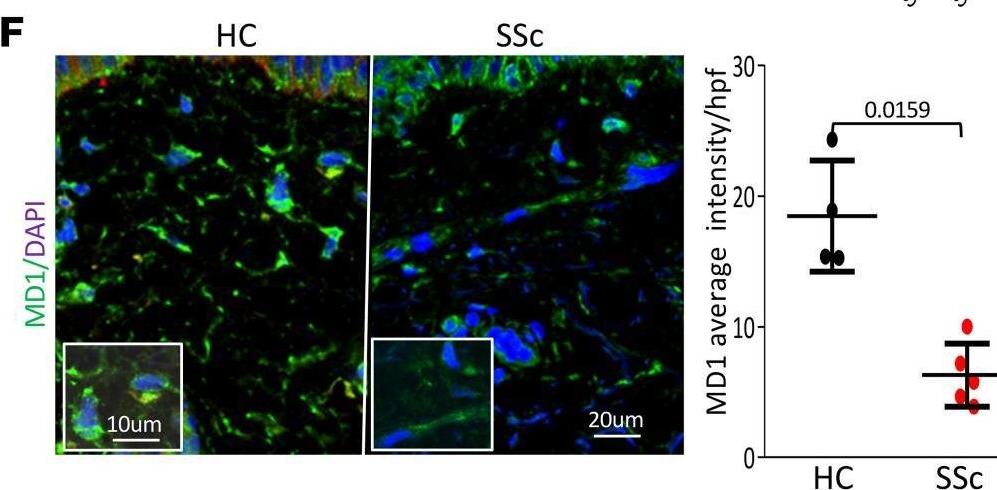 Fig.1.F showing Immunohistochemistry-immunofluorescence in a Homo sapiens (Human) sample from the publication: Deficiency of inhibitory TLR4 homolog RP105 exacerbates fibrosis.