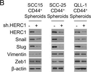 Fig.3.B showing Western Blotting from the publication: HERC1 oncogene enhances stemness and tumorigenic potential in CD44+-derived organoids of head and neck squamous cell carcinoma through IL-6/STAT3 signaling.