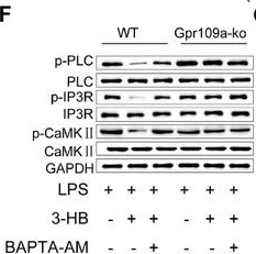 Fig.5.F showing Western Blotting in a Mus musculus (House mouse) sample from the publication: Ketone Body 3-Hydroxybutyrate Ameliorates Atherosclerosis via Receptor Gpr109a-Mediated Calcium Influx.