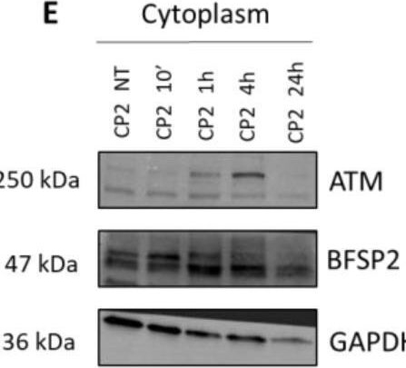 Fig.8.E showing Western Blotting from the publication: The Radiobiological Characterization of Human and Porcine Lens Cells Suggests the Importance of the ATM Kinase in Radiation-Induced Cataractogenesis.