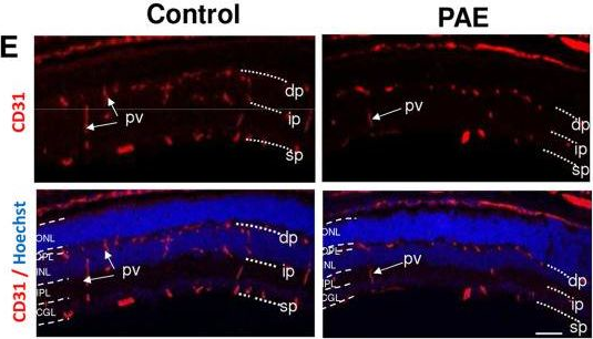 Fig.2.E showing Immunohistochemistry in a Mus musculus (House mouse) sample from the publication: In Utero Alcohol Exposure Impairs Retinal Angiogenesis and the Microvessel-Associated Positioning of Calretinin Interneurons.