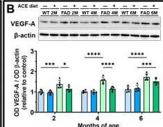 Fig.4.B showing Western Blotting from the publication: An Acebuche Oil-Enriched Diet Prevents Early-Stage Cerebrovascular Alterations in the 5xFAD Mouse Model of Alzheimer's Disease.