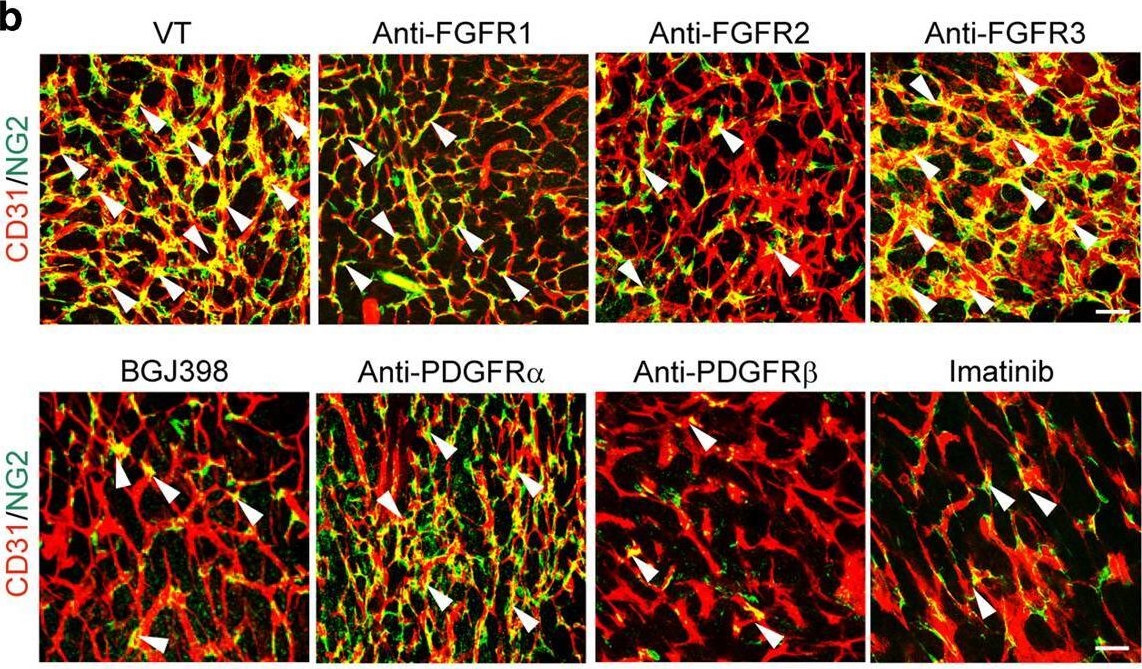 Fig.3.B showing Immunohistochemistry-immunofluorescence in a Mus musculus (House mouse) sample from the publication: Dual roles of endothelial FGF-2-FGFR1-PDGF-BB and perivascular FGF-2-FGFR2-PDGFRβ signaling pathways in tumor vascular remodeling.