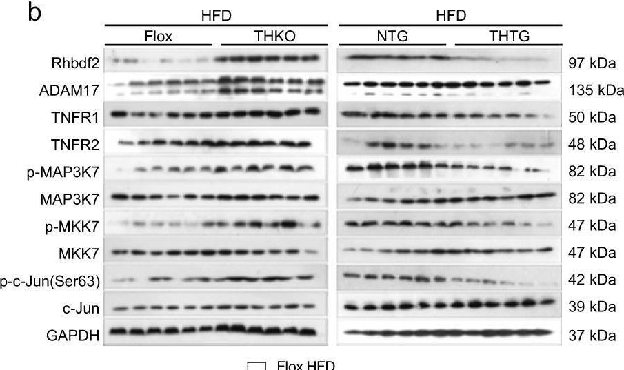 Fig.5.B showing Western Blotting in a Mus musculus (House mouse) sample from the publication: The E3 ubiquitin-protein ligase Trim31 alleviates non-alcoholic fatty liver disease by targeting Rhbdf2 in mouse hepatocytes.