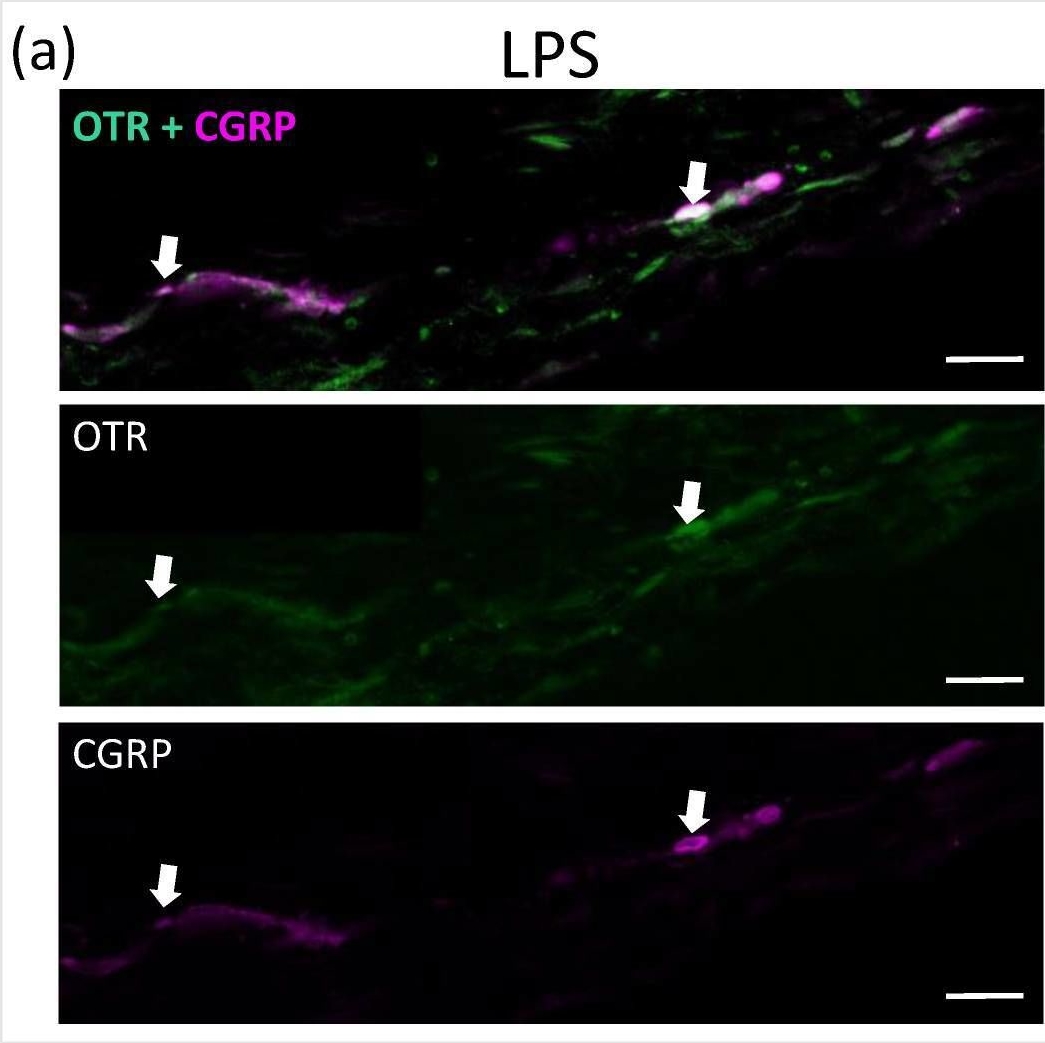 Fig.2.A showing Immunohistochemistry-immunofluorescence from the publication: Oxytocin Receptors on Calvarial Periosteal Innervation: Therapeutic Target for Post-Traumatic Headache?