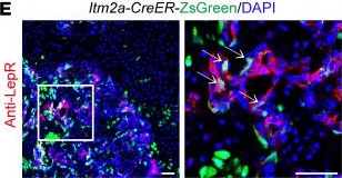 Fig.2.E showing Immunohistochemistry-immunofluorescence from the publication: Itm2a expression marks periosteal skeletal stem cells that contribute to bone fracture healing.