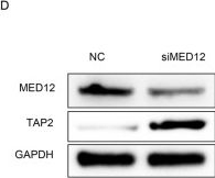 Fig.5.D showing Western Blotting in a Homo sapiens (Human) sample from the publication: MED12-STAT1-TAP2 axis regulates CD8 + T cell cytotoxicity and mediates immunotherapy outcome in non-small cell lung cancer.