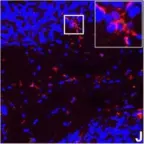 Fig.7.J showing Immunohistochemistry-immunofluorescence in a Mus musculus (House mouse) sample from the publication: IFN-gamma signaling in the central nervous system controls the course of experimental autoimmune encephalomyelitis independently of the localization and composition of inflammatory foci.