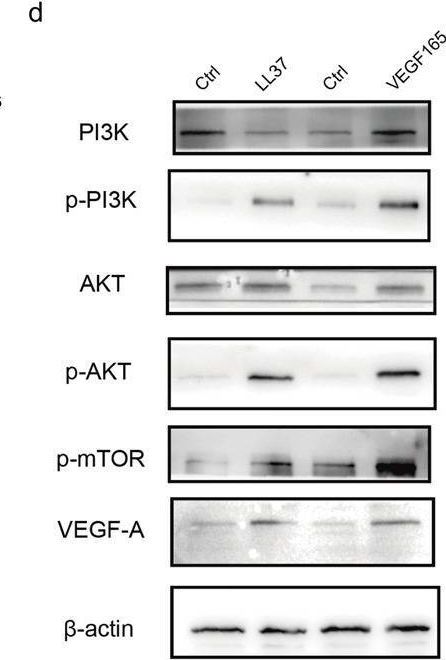 Fig.4.D showing Western Blotting in a Homo sapiens (Human) sample from the publication: LL37 promotes angiogenesis: a potential therapeutic strategy for lower limb ischemic diseases.