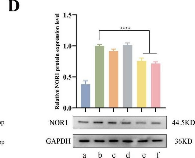 Fig.7.D showing Western Blotting in a Homo sapiens (Human) sample from the publication: Combination therapy based on dual-target biomimetic nano-delivery system for overcoming cisplatin resistance in hepatocellular carcinoma.