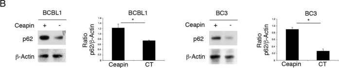 Fig.3.B showing Western Blotting from the publication: IRE1 Alpha/XBP1 Axis Sustains Primary Effusion Lymphoma Cell Survival by Promoting Cytokine Release and STAT3 Activation.