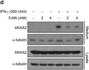 Fig.1.D showing Western Blotting in a Homo sapiens (Human) sample from the publication: Exophagy of annexin A2 via RAB11, RAB8A and RAB27A in IFN-γ-stimulated lung epithelial cells.