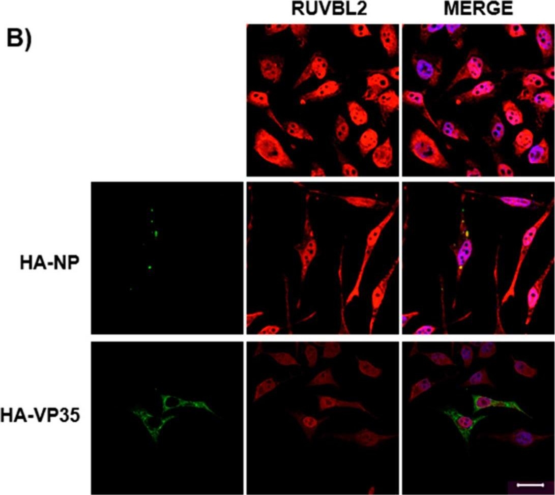 Fig.3.B showing Immunocytochemistry-immunofluorescence in a Homo sapiens (Human) sample from the publication: Identification of RUVBL1 and RUVBL2 as Novel Cellular Interactors of the Ebola Virus Nucleoprotein.