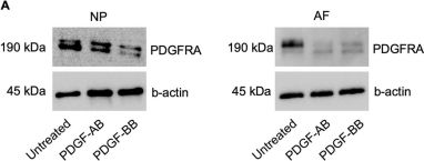 HAAB アルブチン　5g Housing central part ZF 5HP24 1058 401 123 1058401123 from