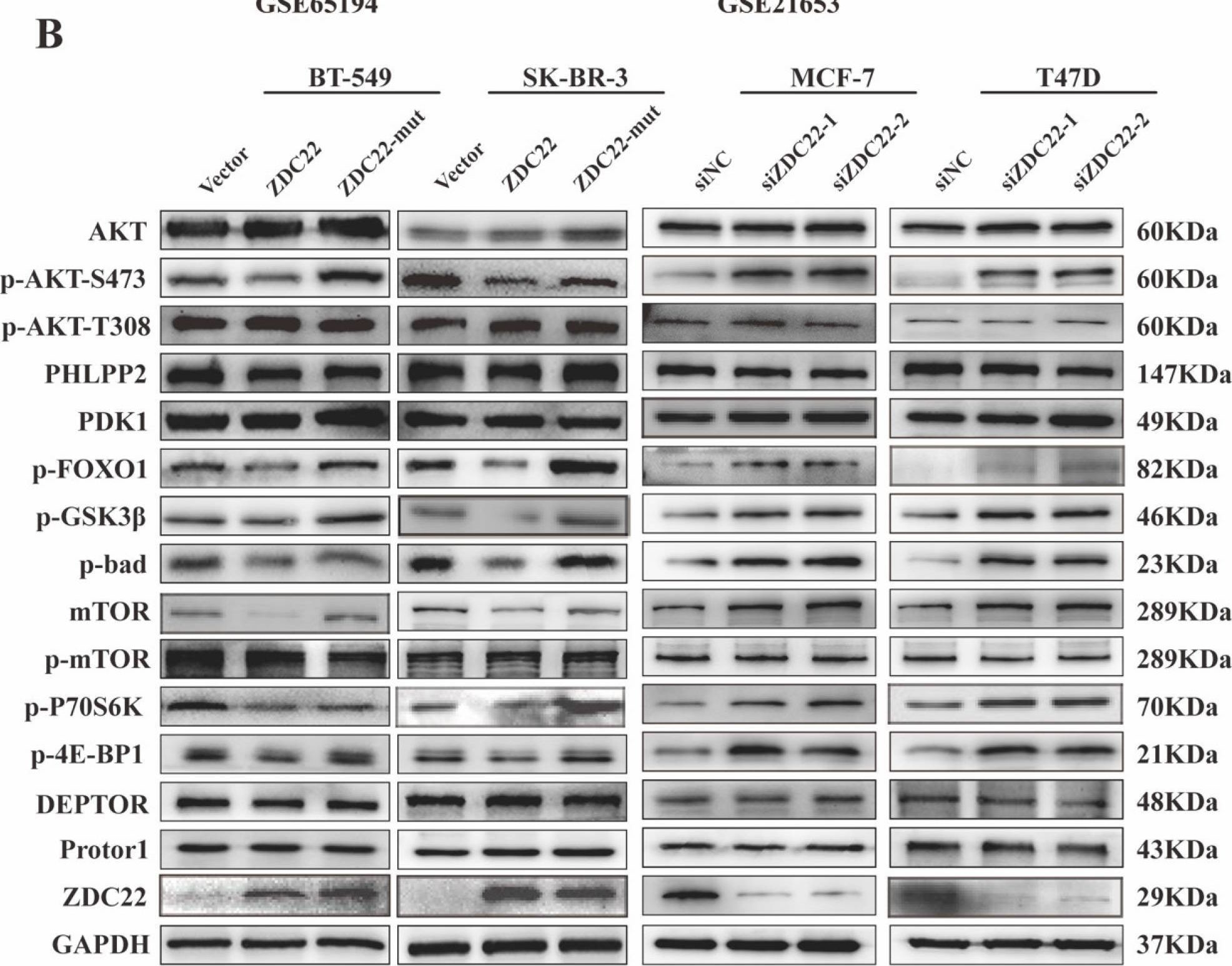 Fig.4.B showing Western Blotting from the publication: ZDHHC22-mediated mTOR palmitoylation restrains breast cancer growth and endocrine therapy resistance.